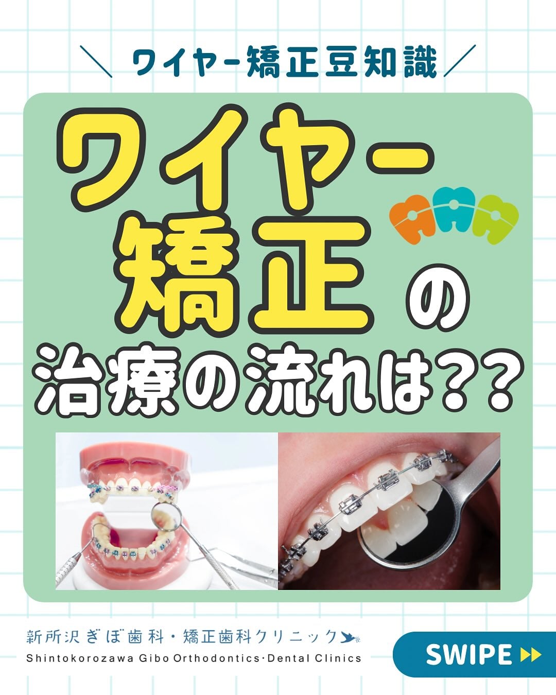 新所沢ぎぼ歯科・矯正歯科クリニック｜新所沢駅東口の目の前にある歯科